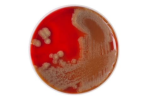 vibrio cholerae growth on blood agar